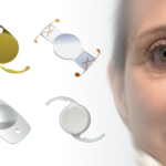 A Brief Introduction to Intraocular Lenses