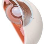 So Then, How Is Cataract Surgery Done? (post 8 of 9)